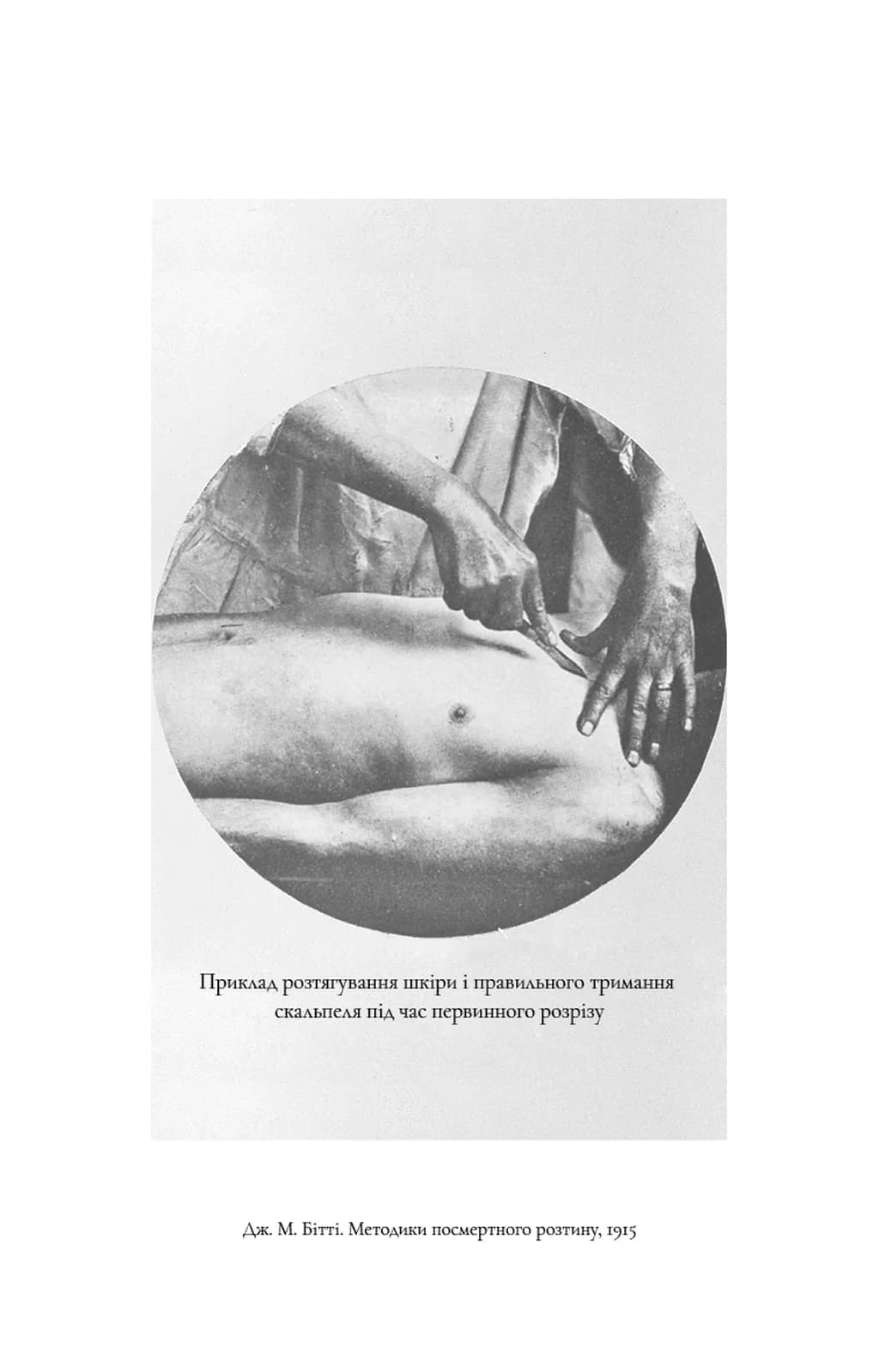 По сліду Джека-Різника. Книга 1 — мініатюра 5